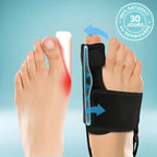 Attelle orthopédique ajustable noire pour la correction de l'hallux valgus, conçue avec des sangles pour redresser le gros orteil et soulager la pression sur l'oignon du pied.