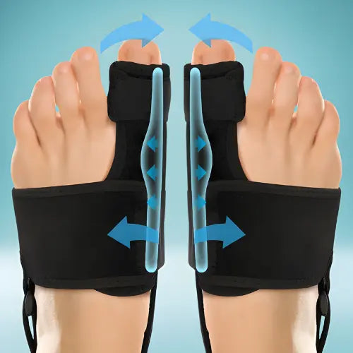 Orthèse de pied portée pour stabiliser l'articulation et prévenir l'aggravation future de la déformation en oignon.